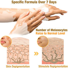 Load image into Gallery viewer, BeeVenom Vitiligo Treatment Cream
