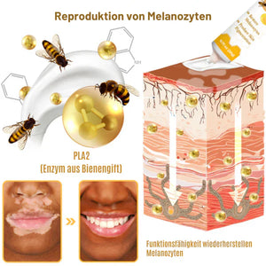 Fivfivgo™ BeeVenom Vitiligo Behandlung Creme