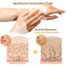 Load image into Gallery viewer, Fivfivgo™ BeeVenom Vitiligo Behandlung Creme
