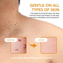 Load image into Gallery viewer, Sticthly TagRecede Bee Venom Treatment Spray
